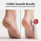 🦶Grattoir Pieds Double Face | Adieu Callosités | Pieds Doux ✨⏳Spécial à durée limitée⏰